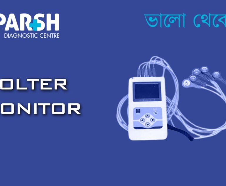 Holter Monitor