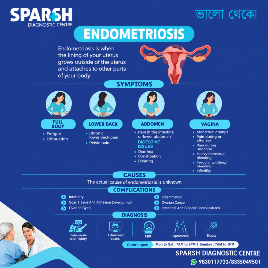 Endometriosis