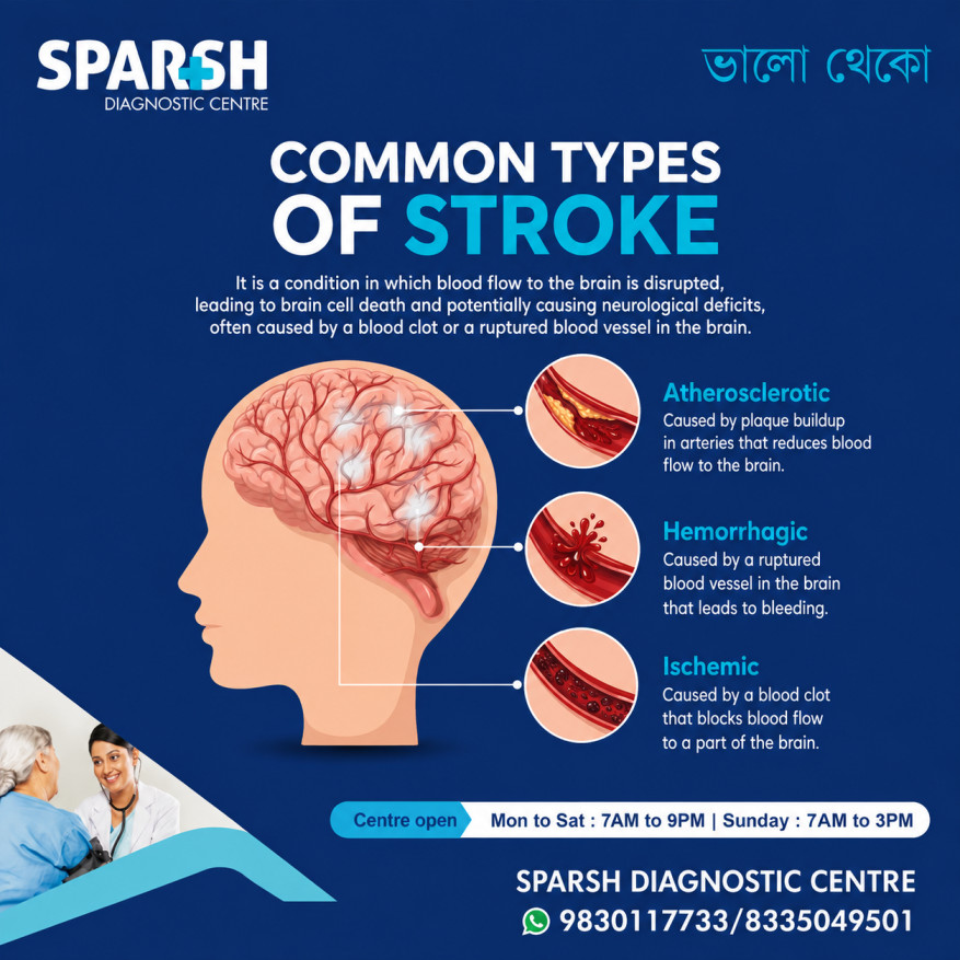 Types Of Stroke