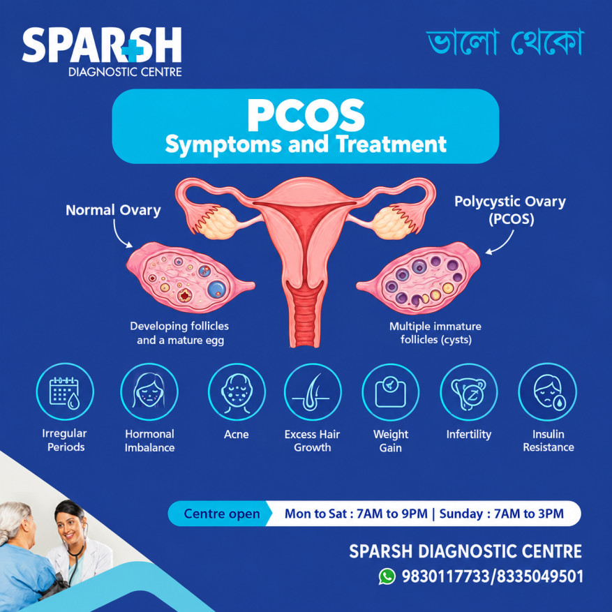 Polycystic Ovary Syndrome PCOS