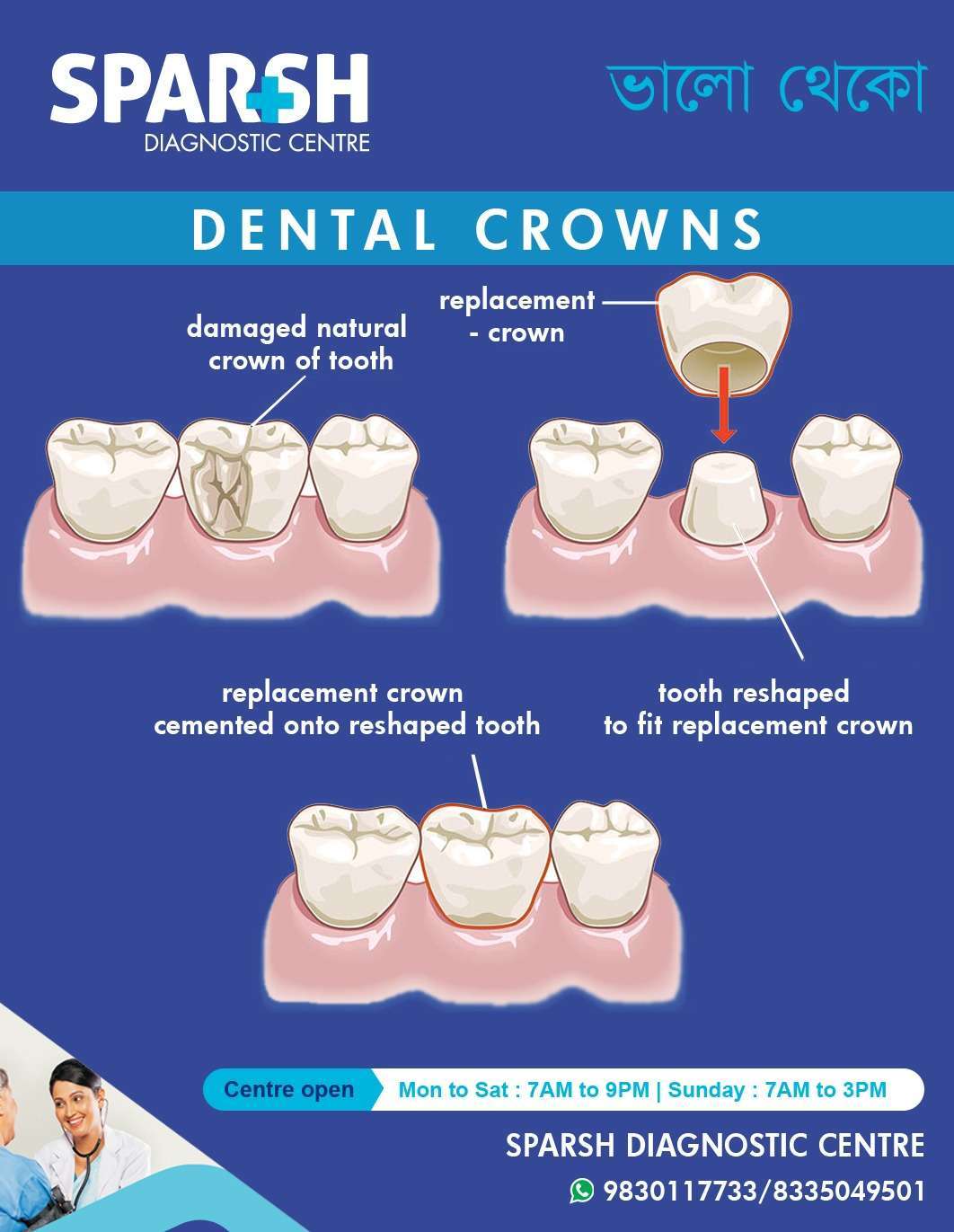 Dental Crowns Sparsh Diagnostic Center
