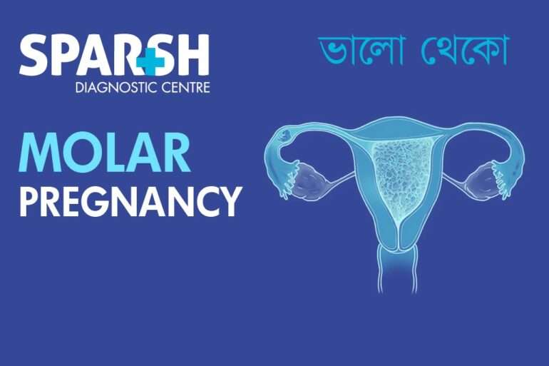 Molar Pregnancy - Sparsh Diagnostic Center