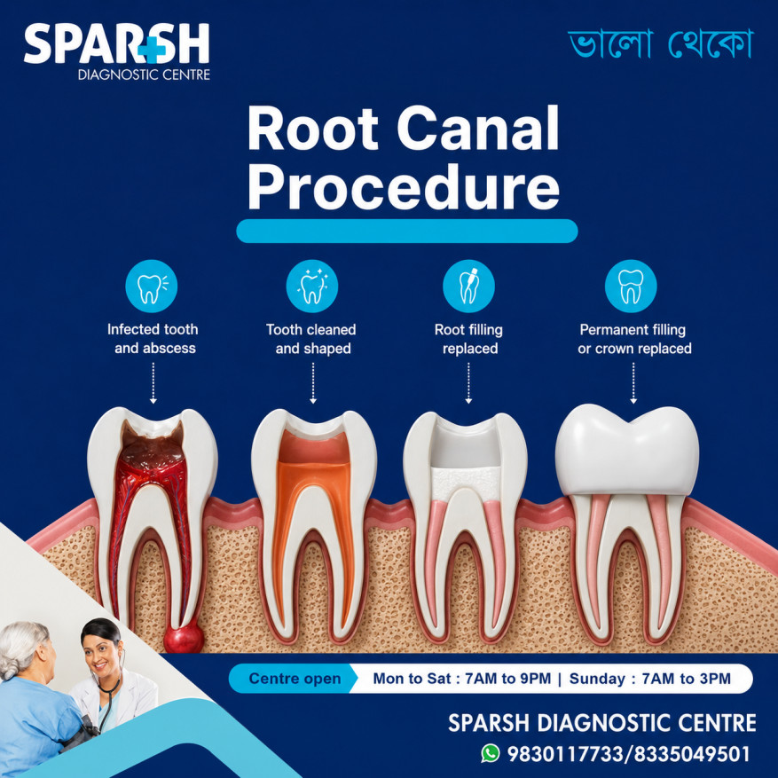 Root Canal Treatment RCT