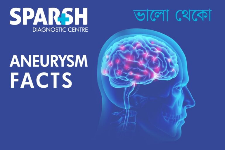 Aneurysms: Silent Threat to Your Health - Sparsh Diagnostic Center