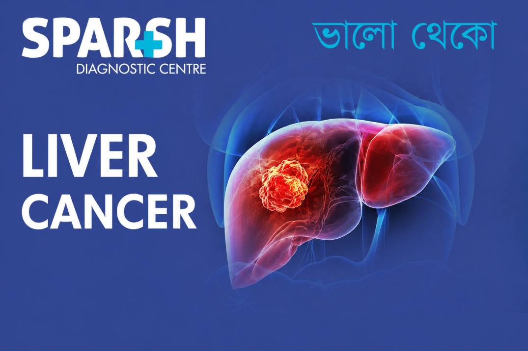 Liver Cancer
