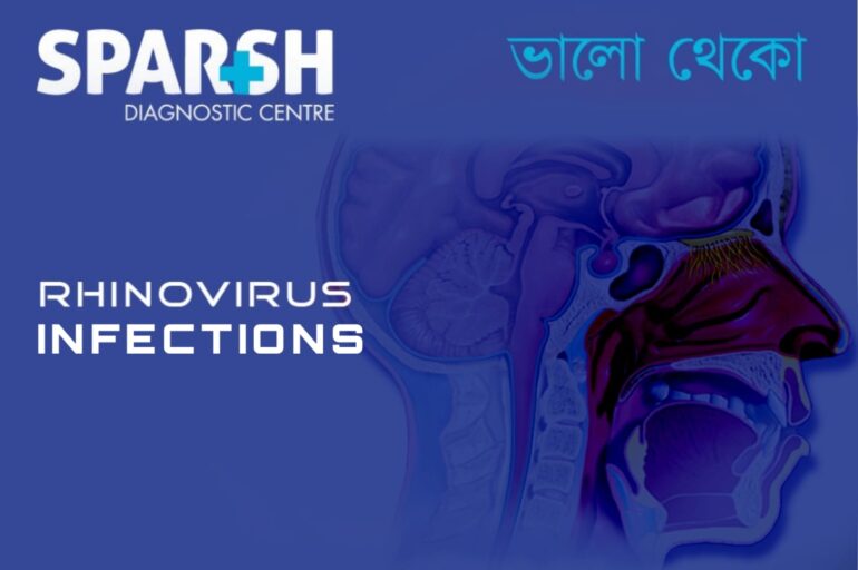 Rhinovirus Infections - Sparsh Diagnostic Center