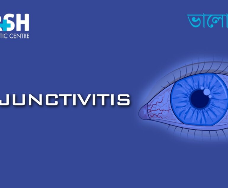 Conjunctivitis
