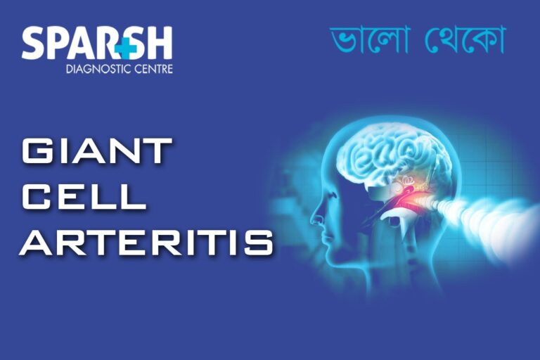 Giant Cell Arteritis - Sparsh Diagnostic Center