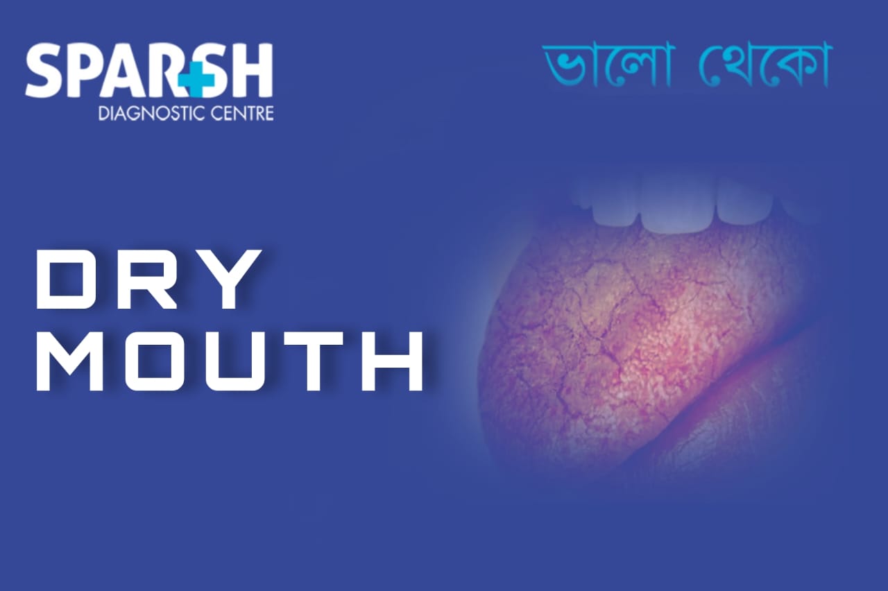 Dry mouth