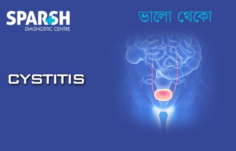 Understanding Cystitis - Sparsh Diagnostic Center