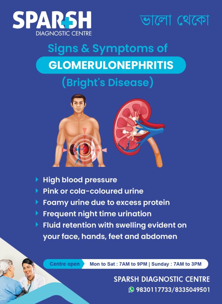 Glomerulonephritis