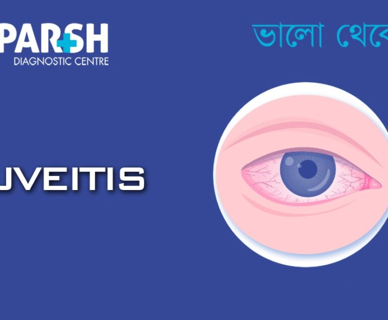 Uveitis
