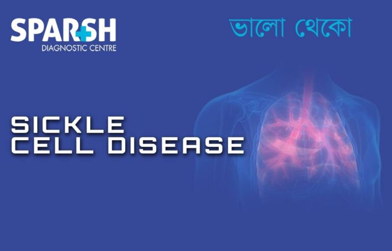 Sickle Cell Disease - Sparsh Diagnostic Center