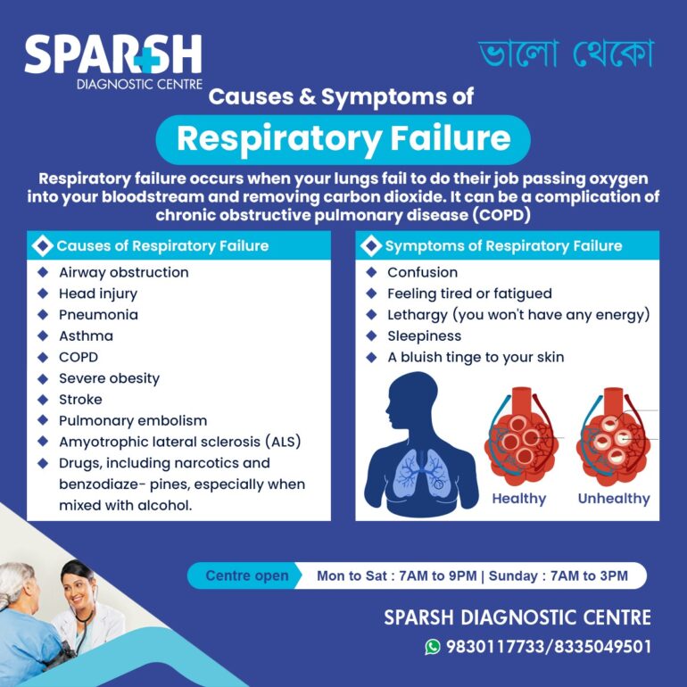 Respiratory Failure - Sparsh Diagnostic Center