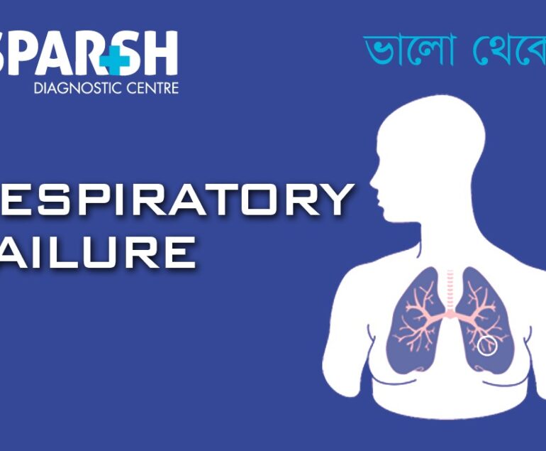 Respiratory failure