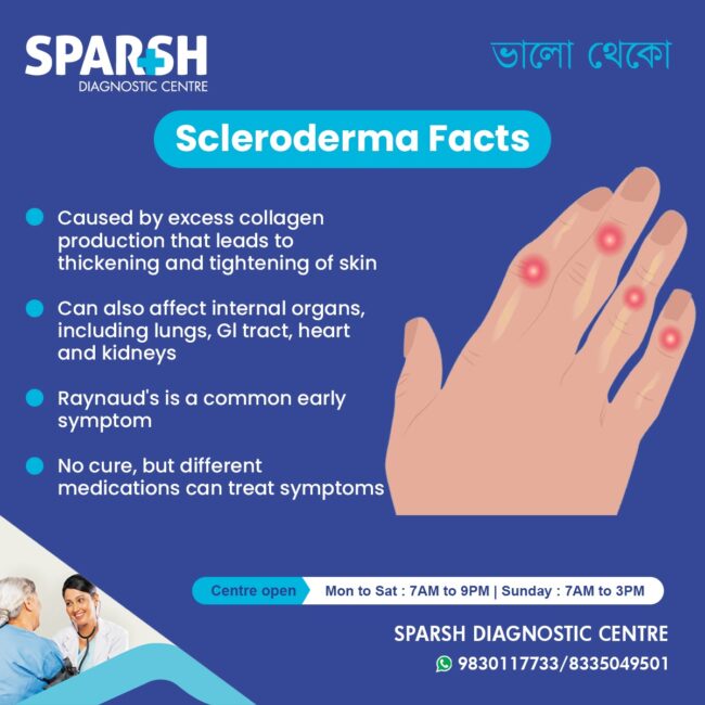 Scerloderma Rash Scleroderma - Sparsh Diagnostic Center