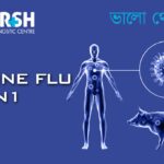 Swine Flu (H1N1)