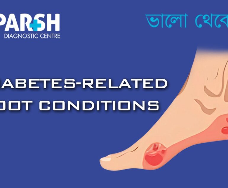 Diabetes-Related Foot Conditions