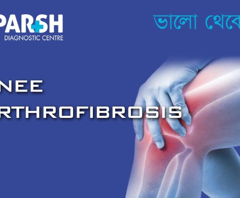 Knee Arthrofibrosis