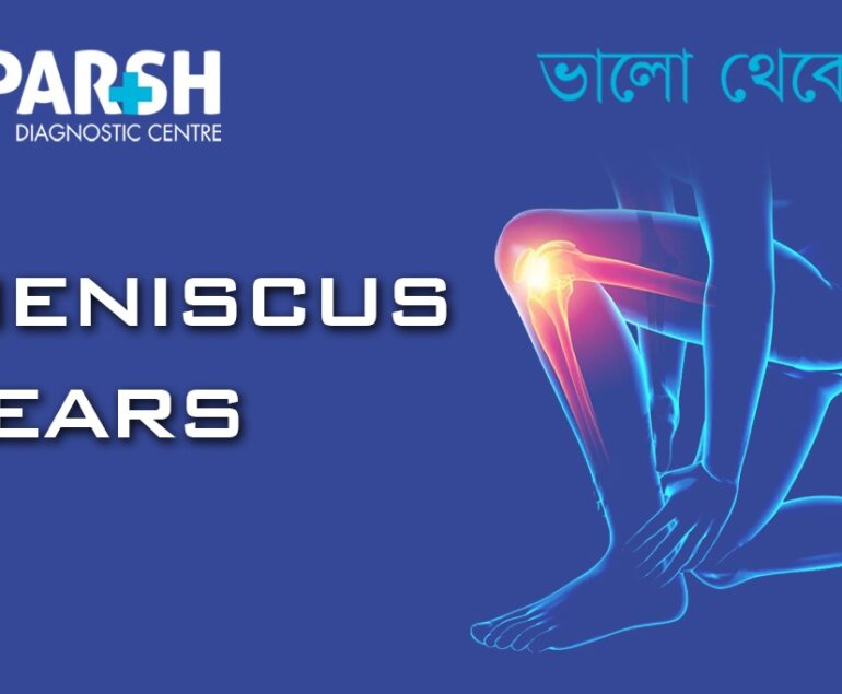 Meniscus Tear