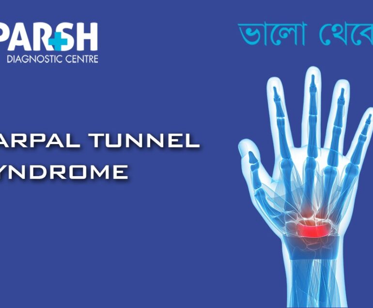Carpal Tunnel Syndrome