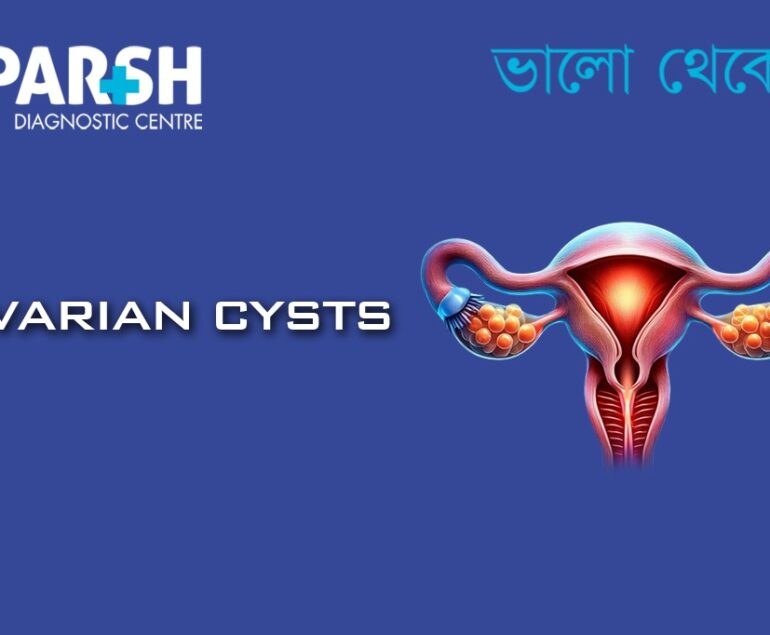 Ovarian Cysts