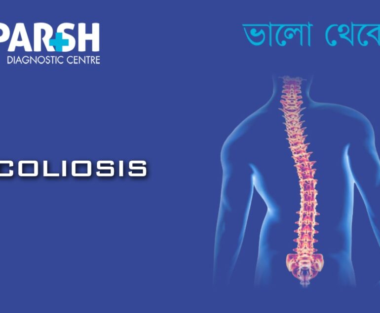 Scoliosis