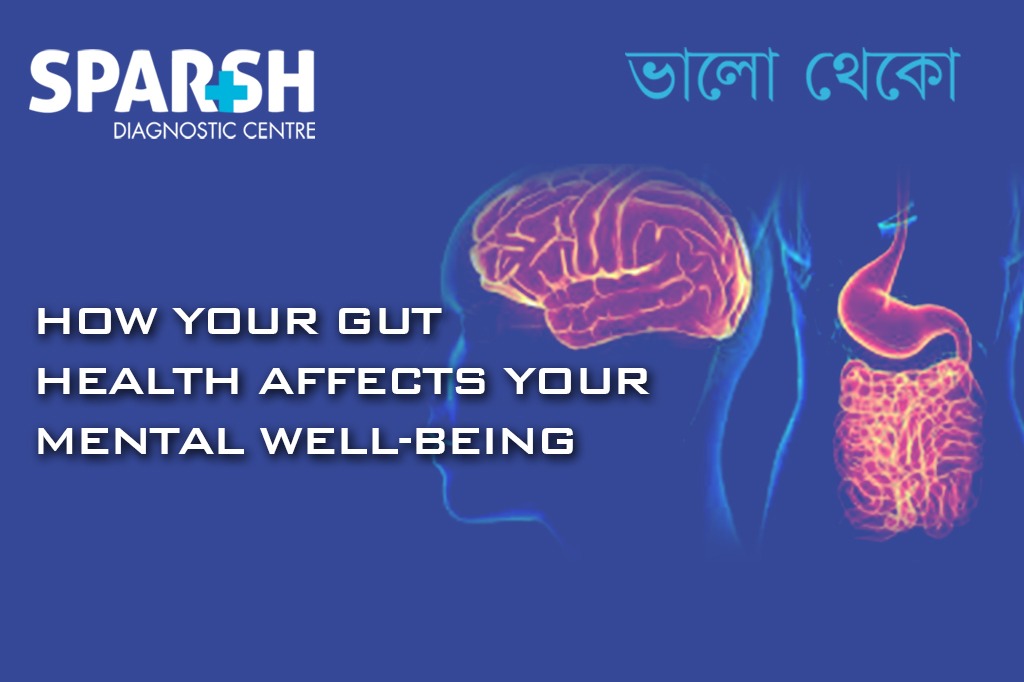 How Your Gut Health Affects Your Mental Well-being