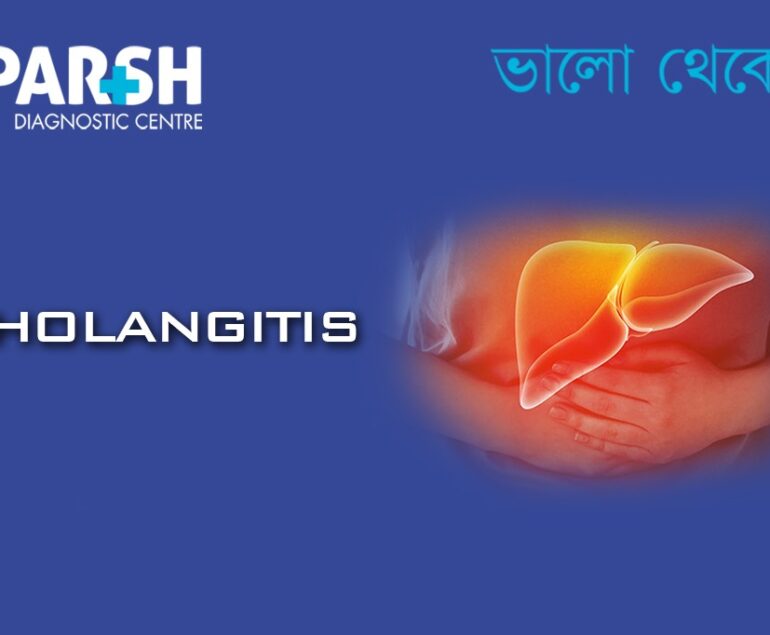 Cholangitis. Blood testing service.