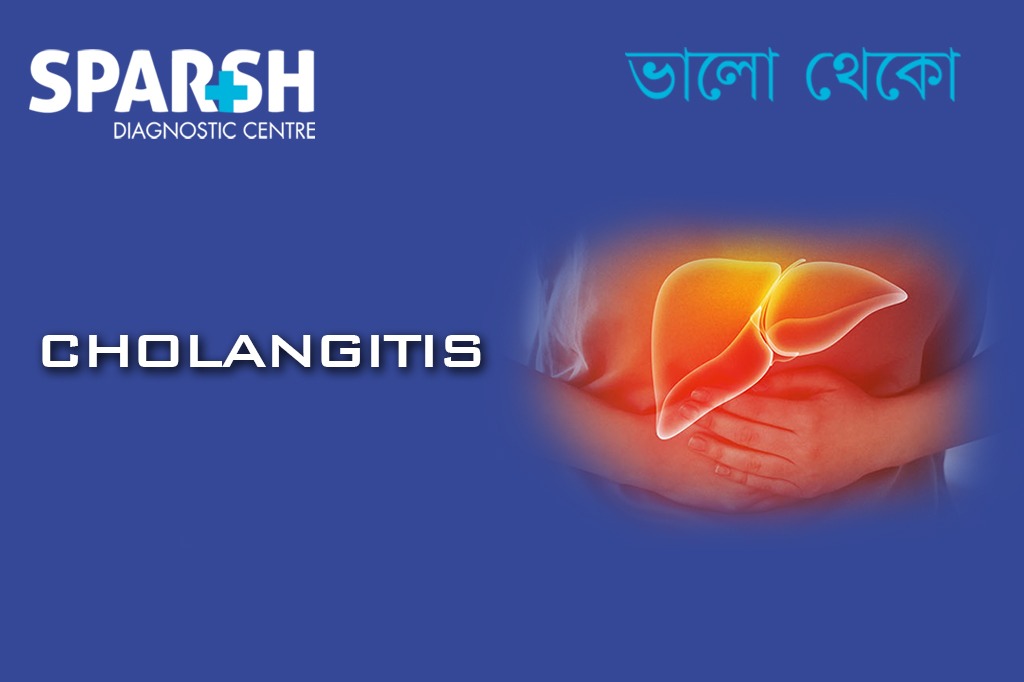 Cholangitis. Blood testing service.