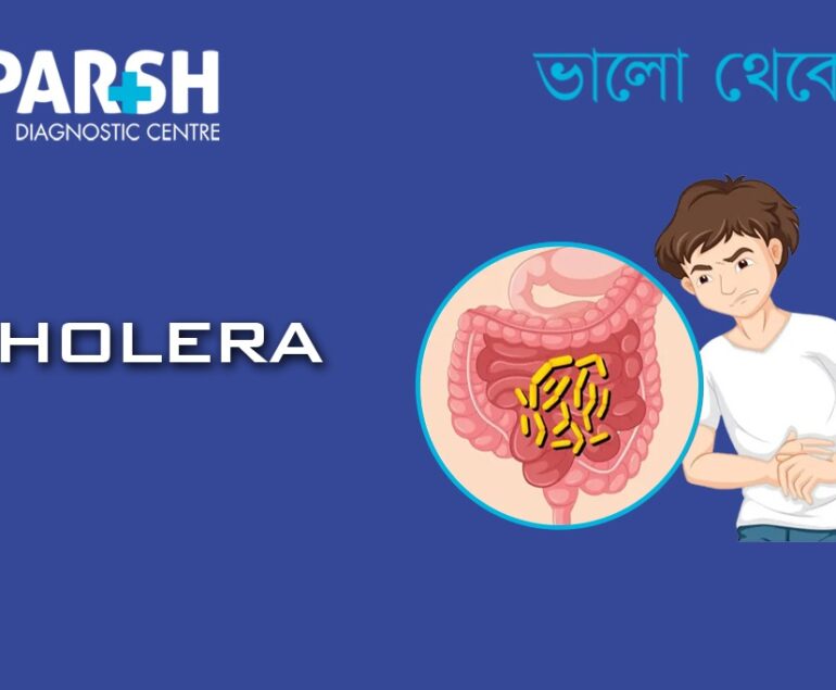 Cholera. Blood testing service.
