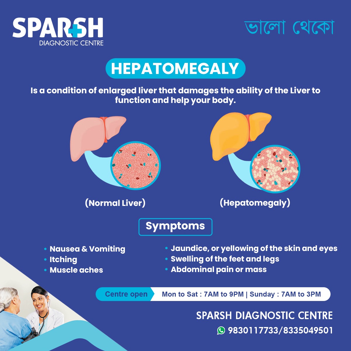 Hepatomegaly