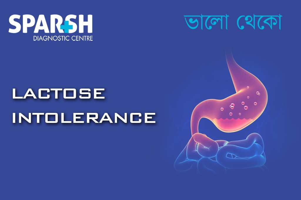 Lactose Intolerance. Blood testing service.