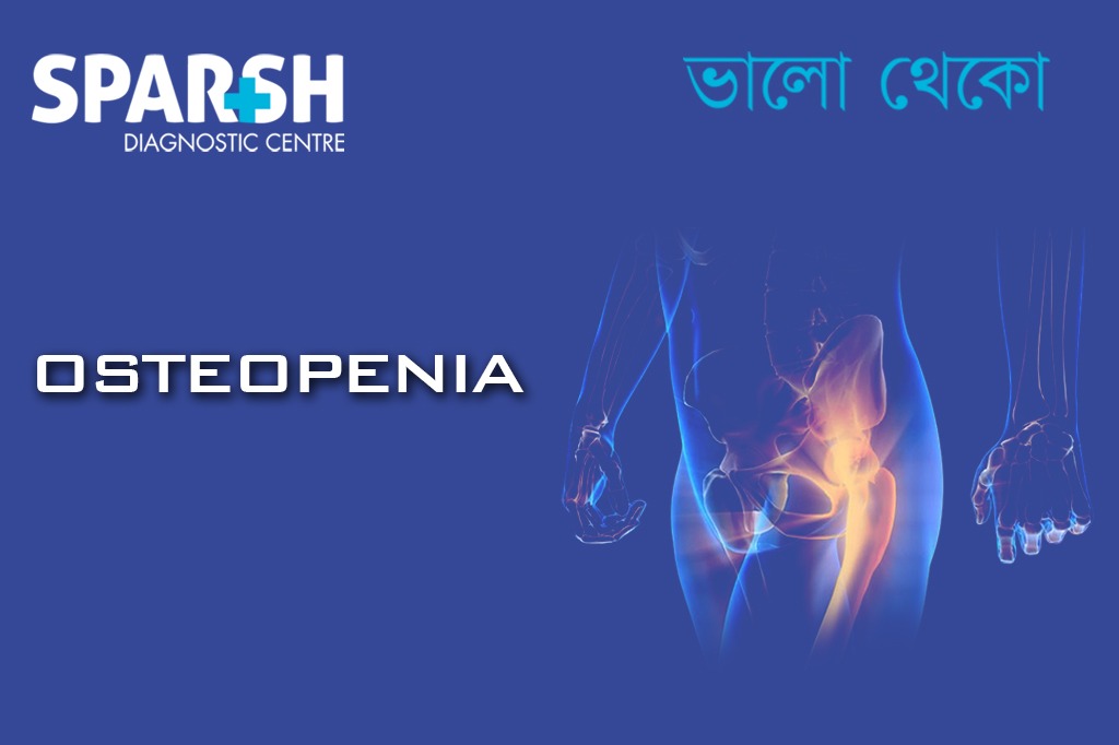 Osteopenia. Blood testing service.