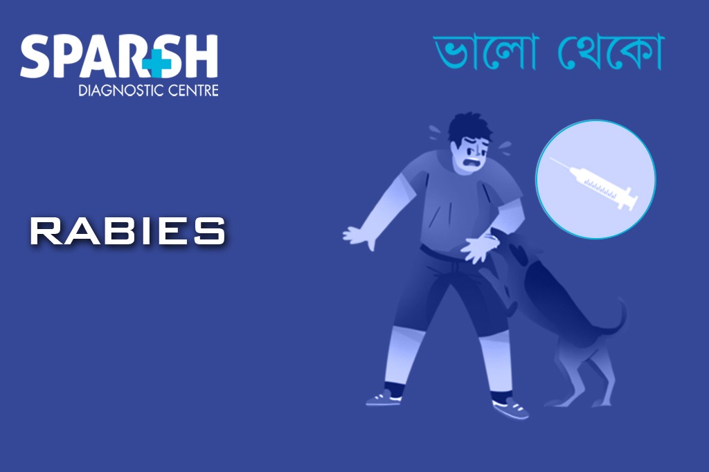 Rabies. Blood testing service.