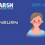Sunburn. Blood testing service.