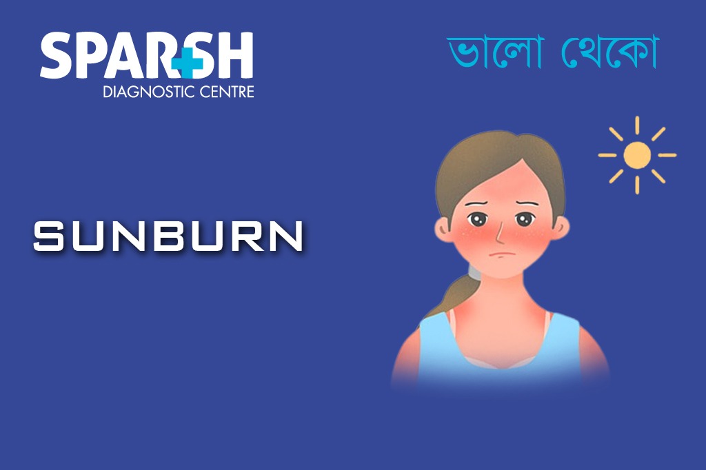 Sunburn. Blood testing service.