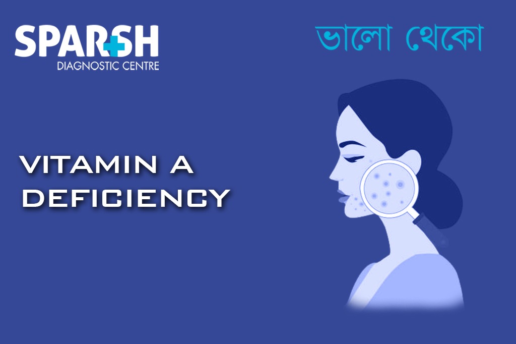 Vitamin A Deficiency