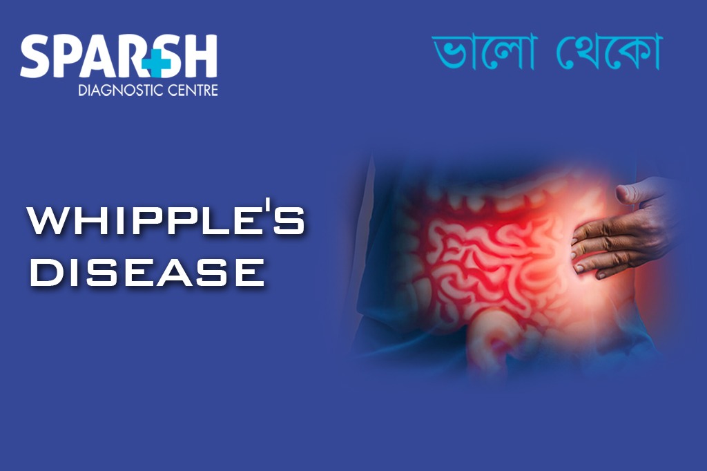 Whipples Disease. USG. Pathologist.