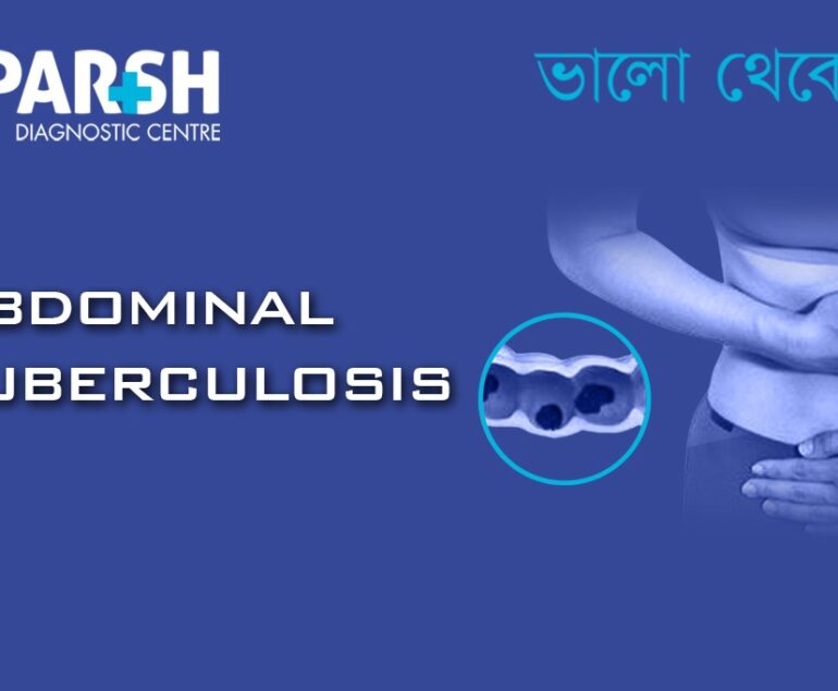 Abdominal Tuberculosis. USG.