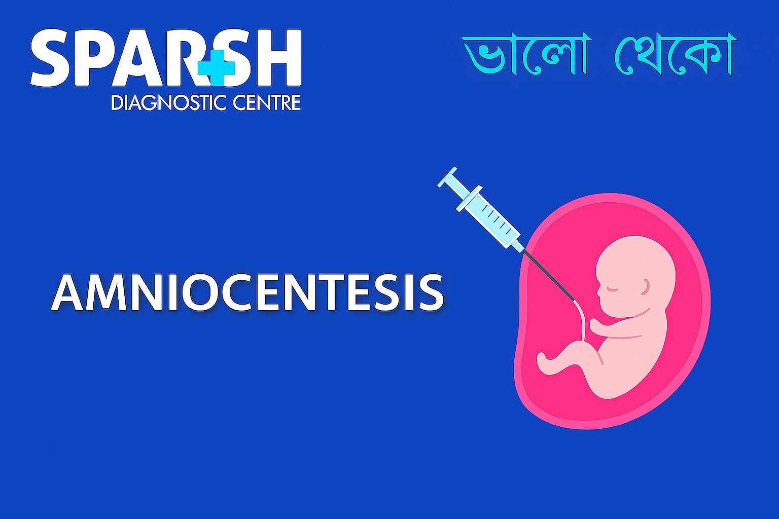 Amniocentesis