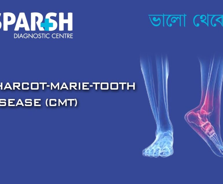Charcot-Marie-Tooth Disease (CMT)