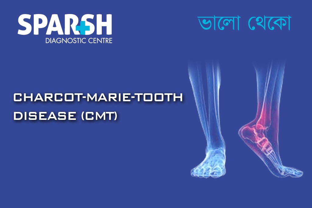 Charcot-Marie-Tooth Disease (CMT)