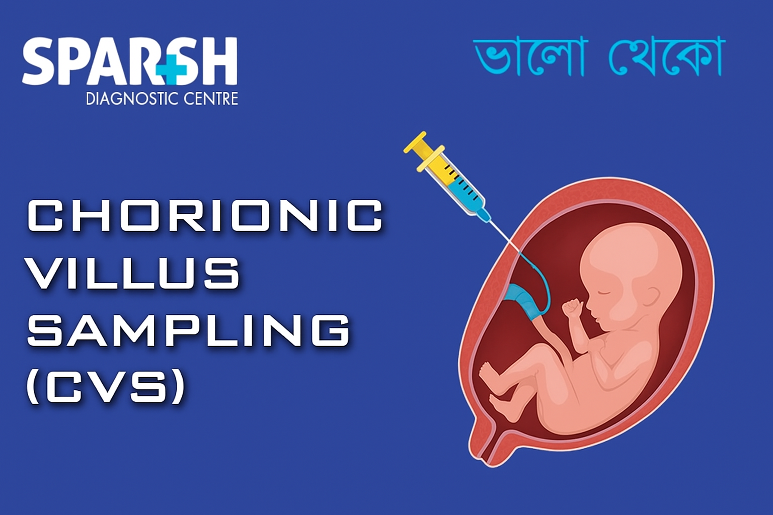 Chorionic Villus Sampling CVS