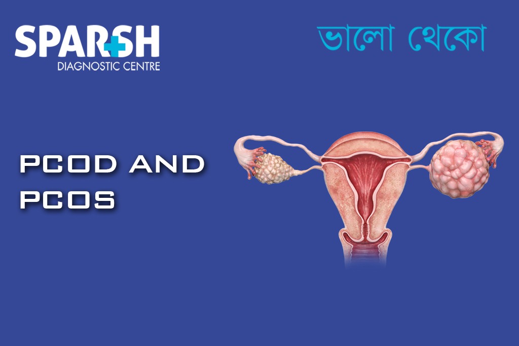 Difference Between PCOS And PCOD