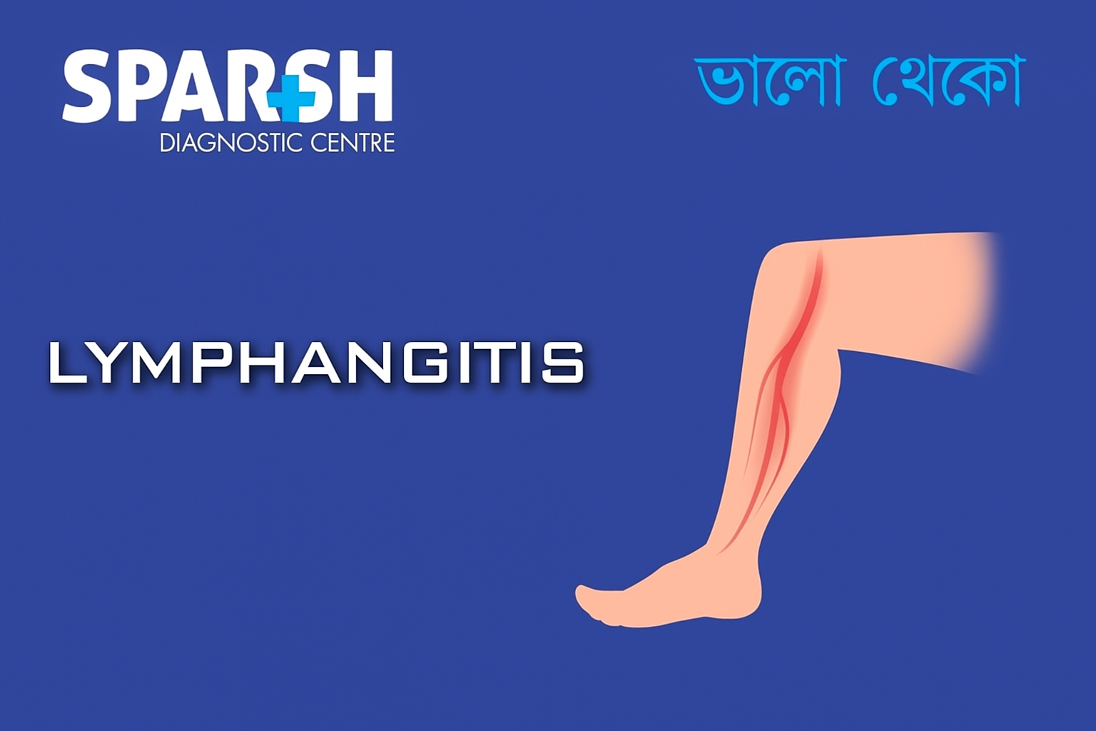 Lymphangitis