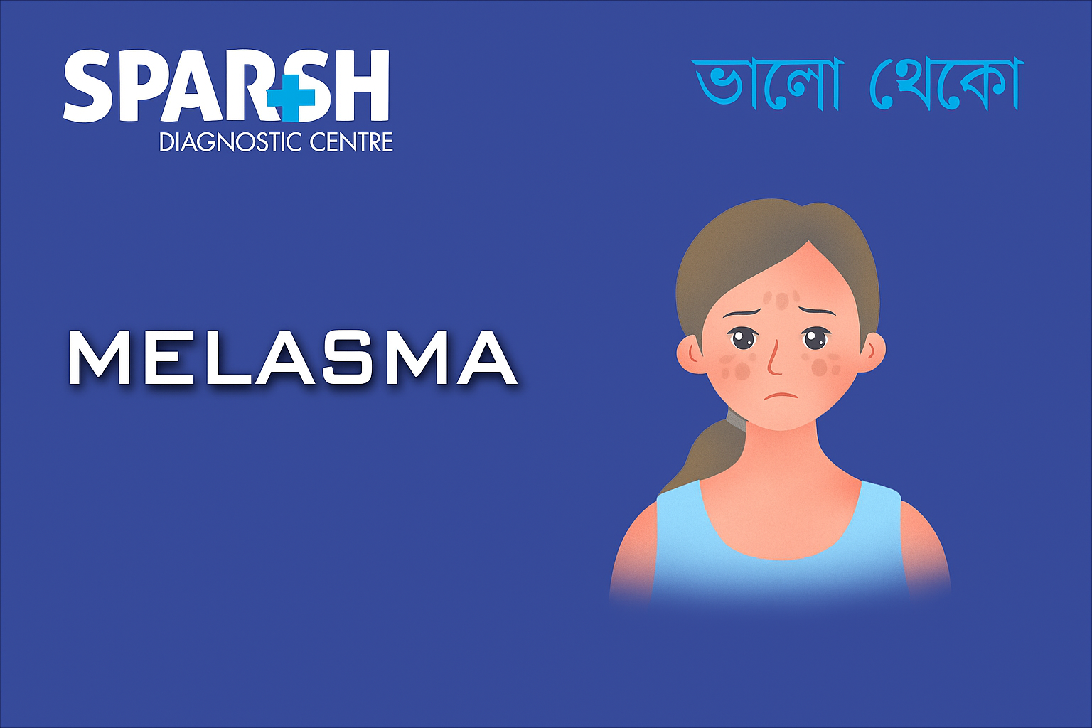 Melasma