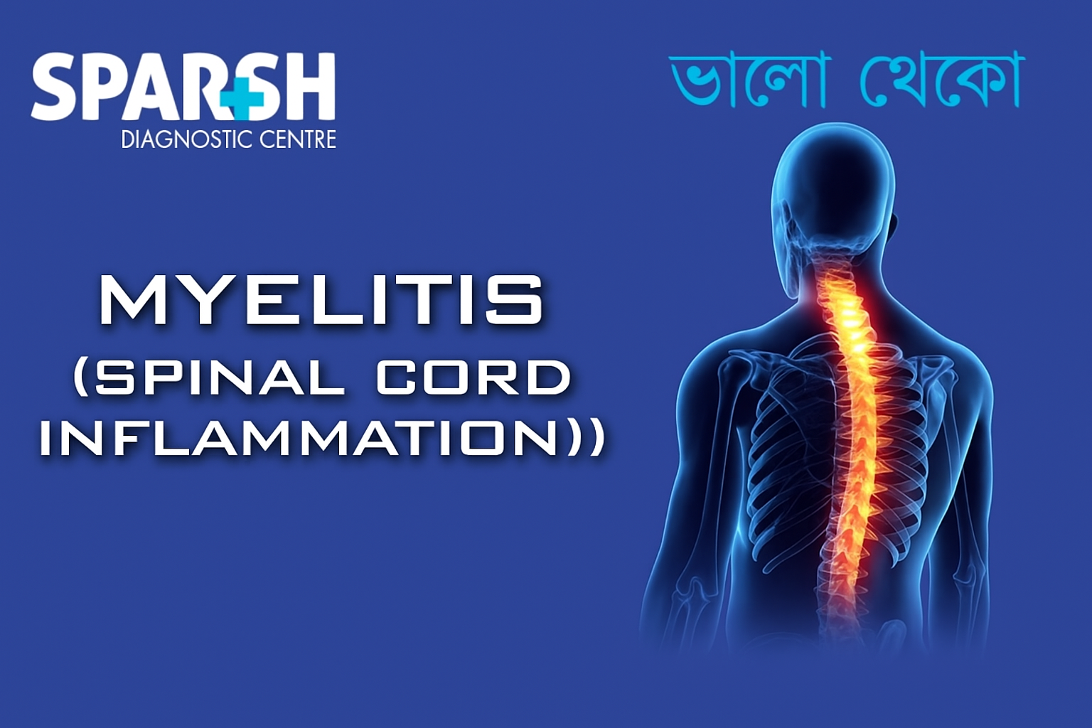 Myelitis