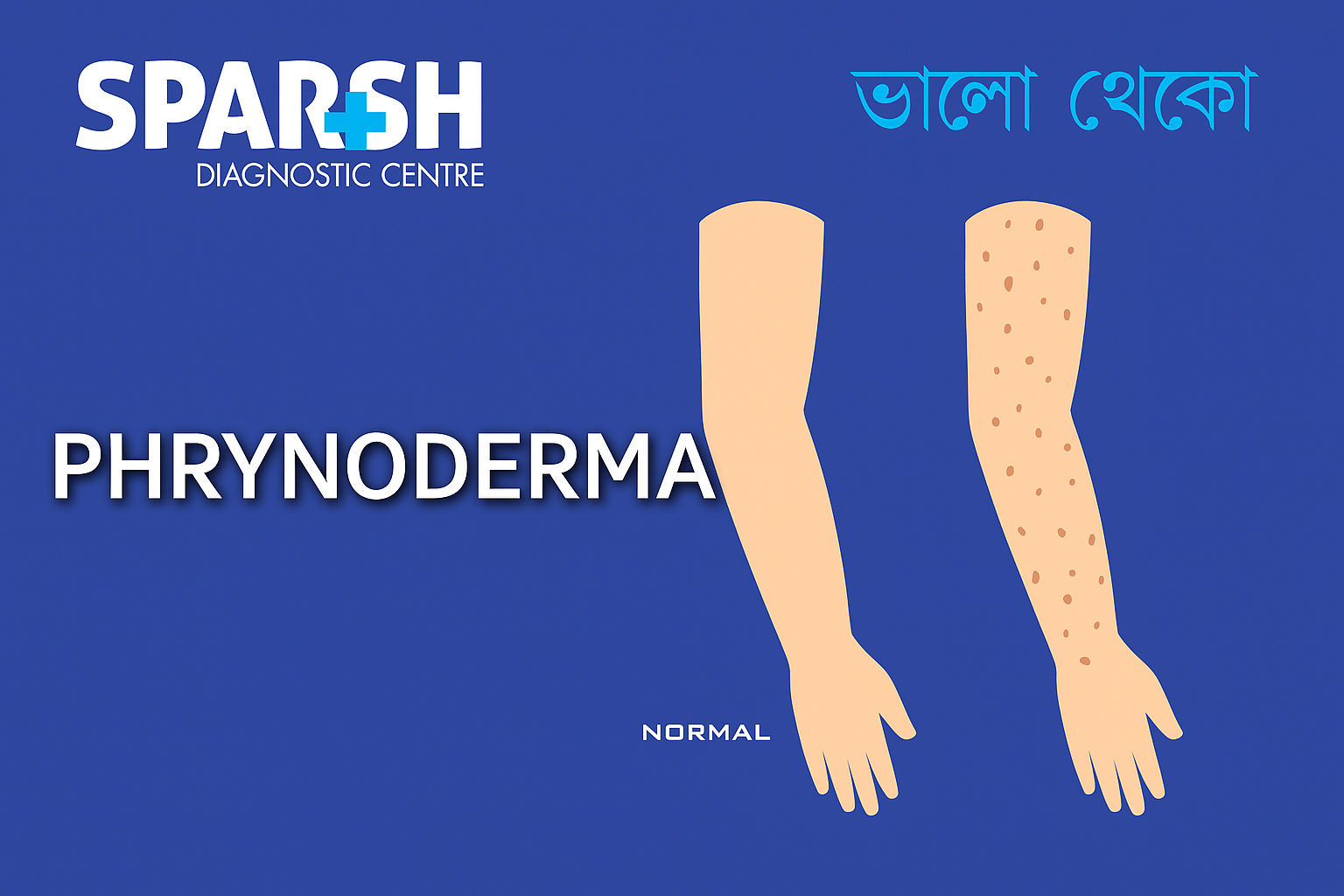 Phrynoderma