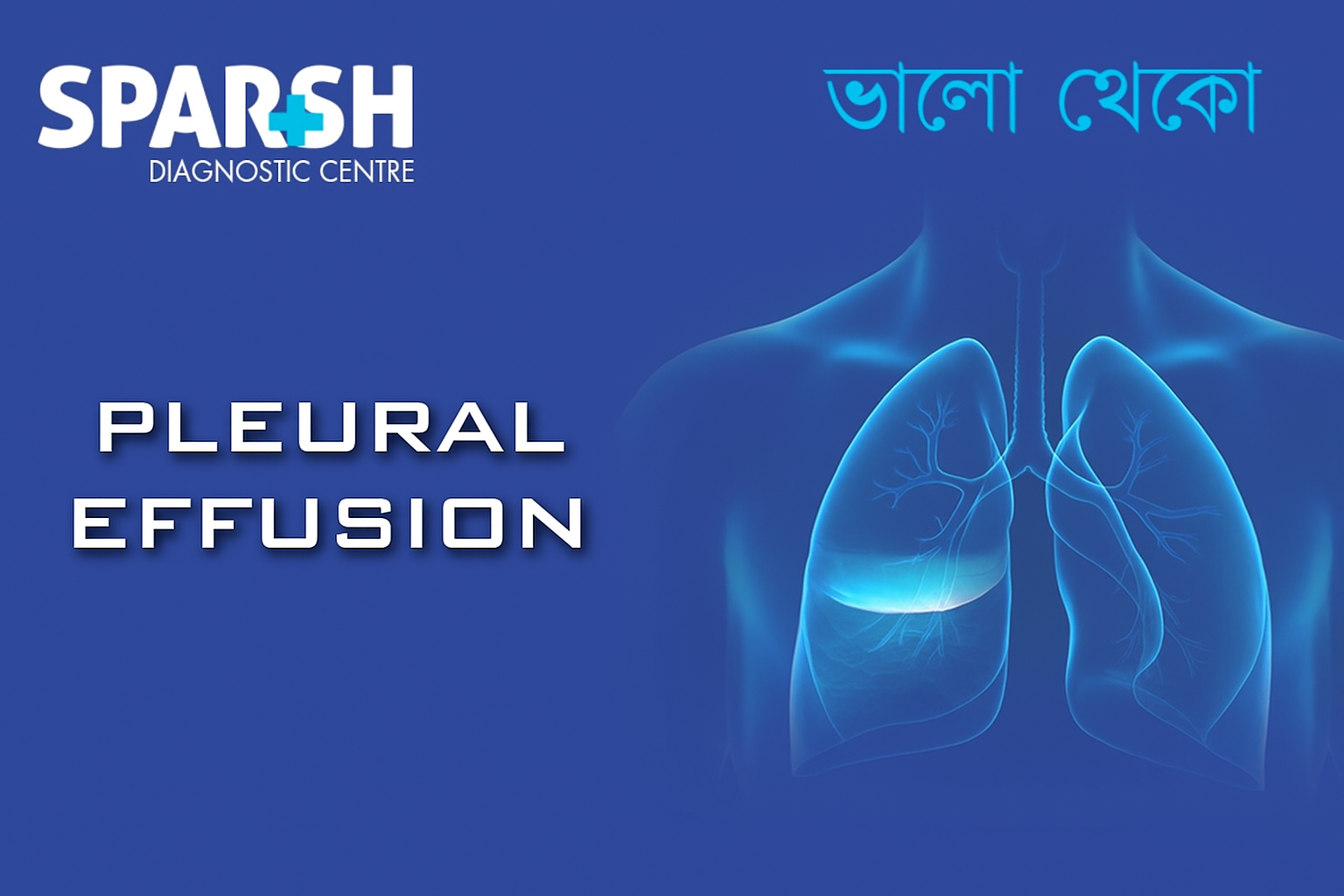 Pleural Effusion